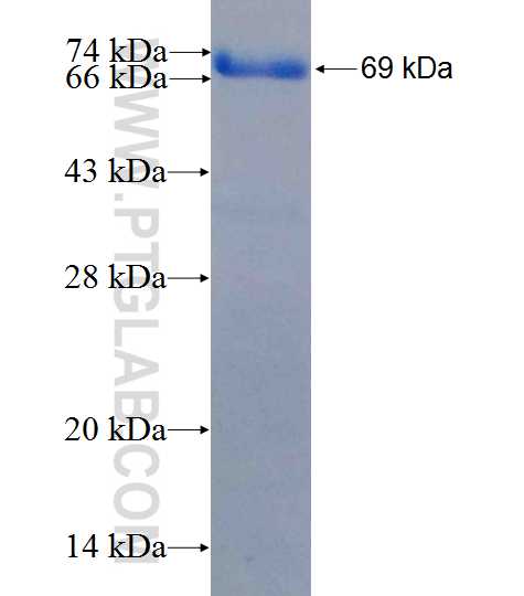 XPA fusion protein Ag26249 SDS-PAGE XPA fusion protein Ag26249 SDS-PAGE