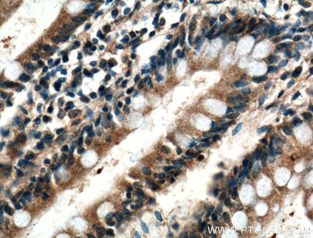 IHC staining of human small intestine using 10661-1-AP