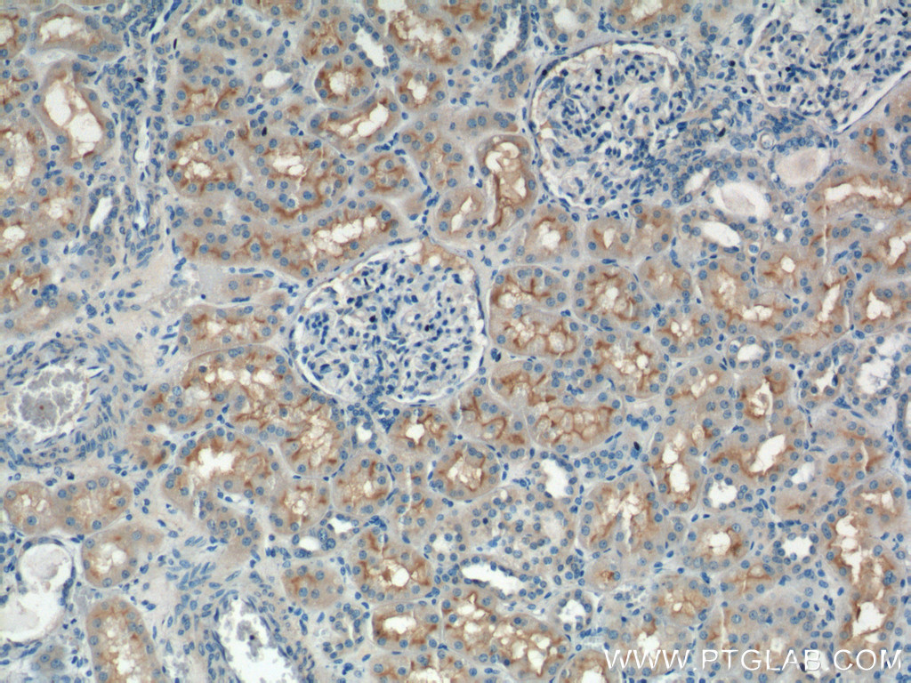 IHC staining of human kidney using 25945-1-AP