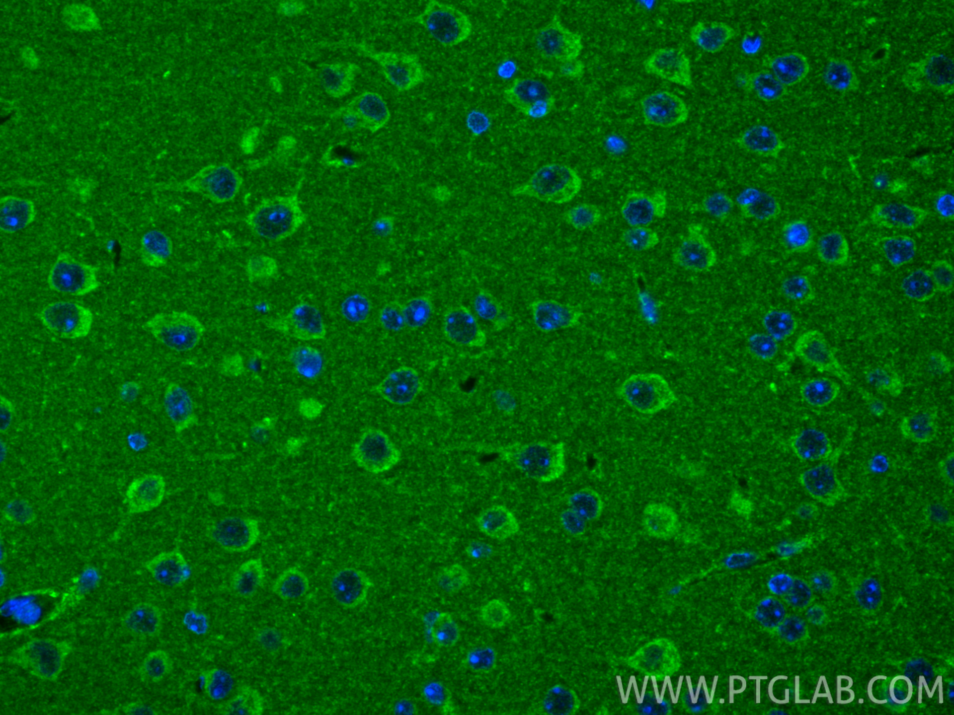 IF Staining of mouse brain using 15655-1-AP IF Staining of mouse brain using 15655-1-AP