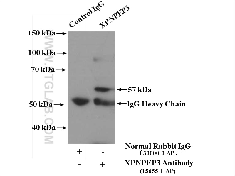 IP experiment of PC-3 using 15655-1-AP