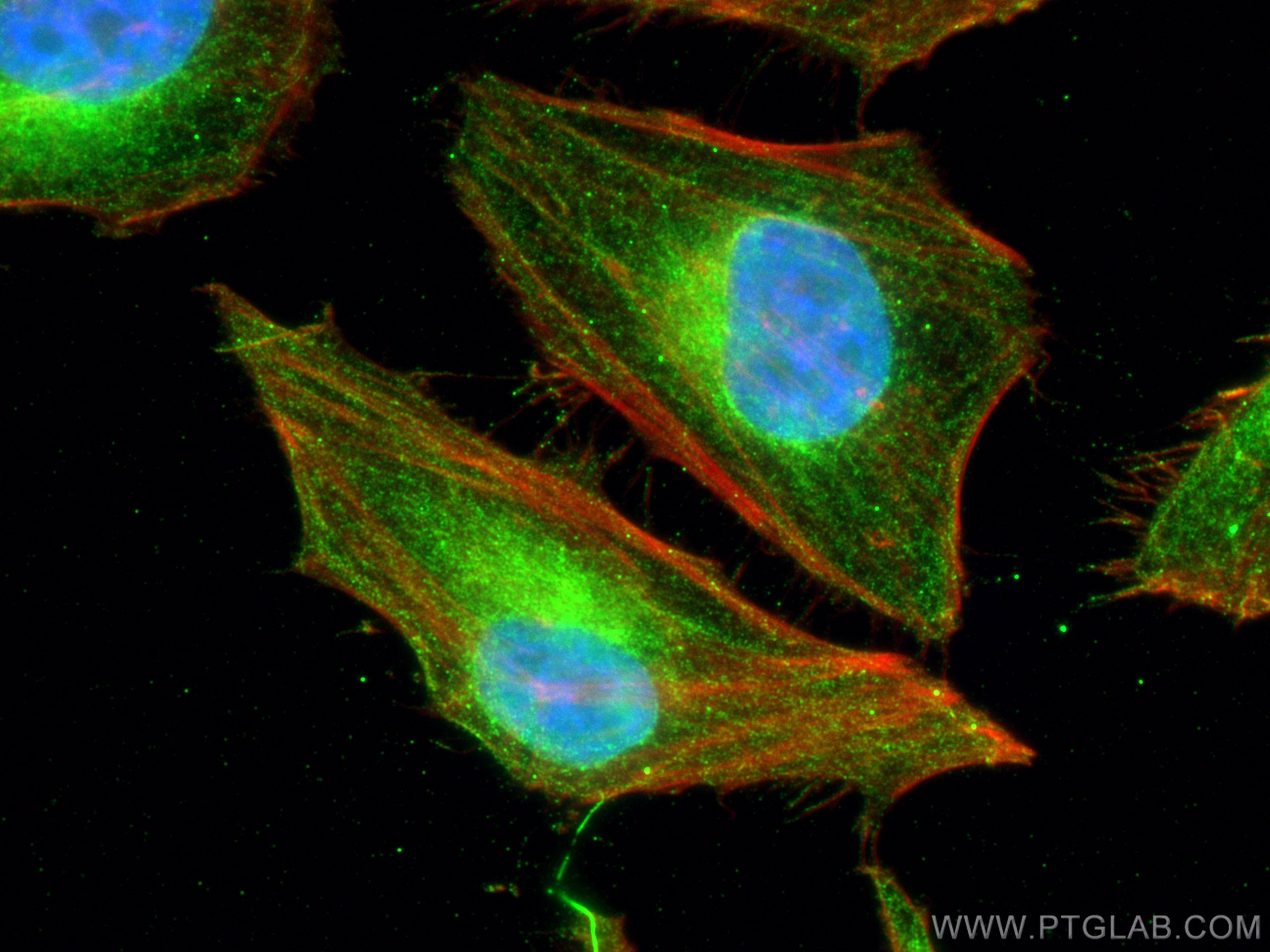 IF Staining of HeLa using 66763-1-Ig (same clone as 66763-1-PBS)