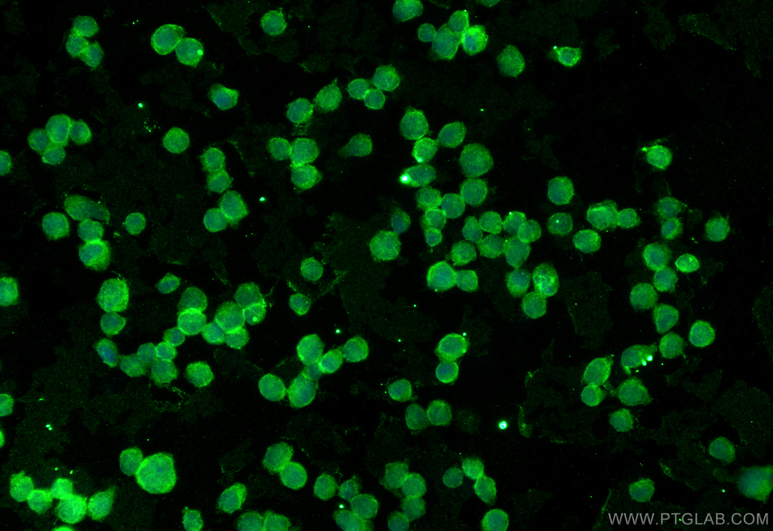 IF Staining of K-562 using 66763-1-Ig IF Staining of K-562 using 66763-1-Ig