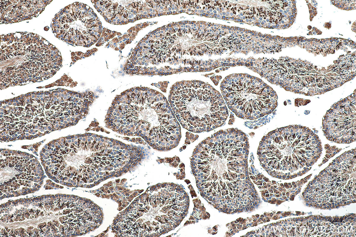 IHC staining of mouse testis using 28628-1-AP (same clone as 28628-1-PBS)