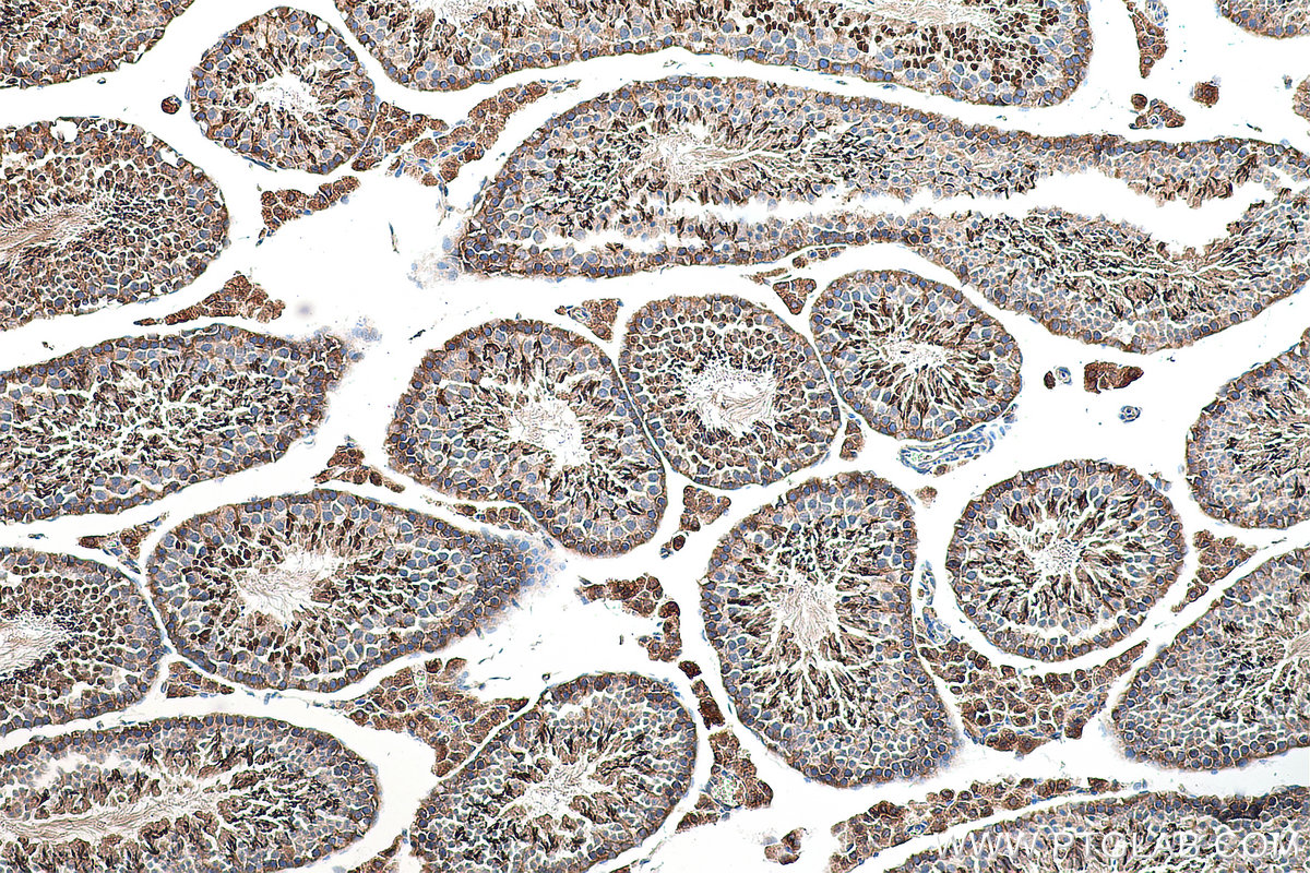 IHC staining of mouse testis using 28628-1-AP