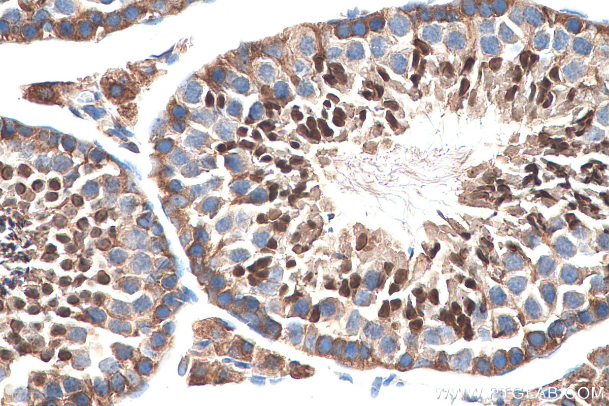 IHC staining of mouse testis using 28628-1-AP (same clone as 28628-1-PBS)