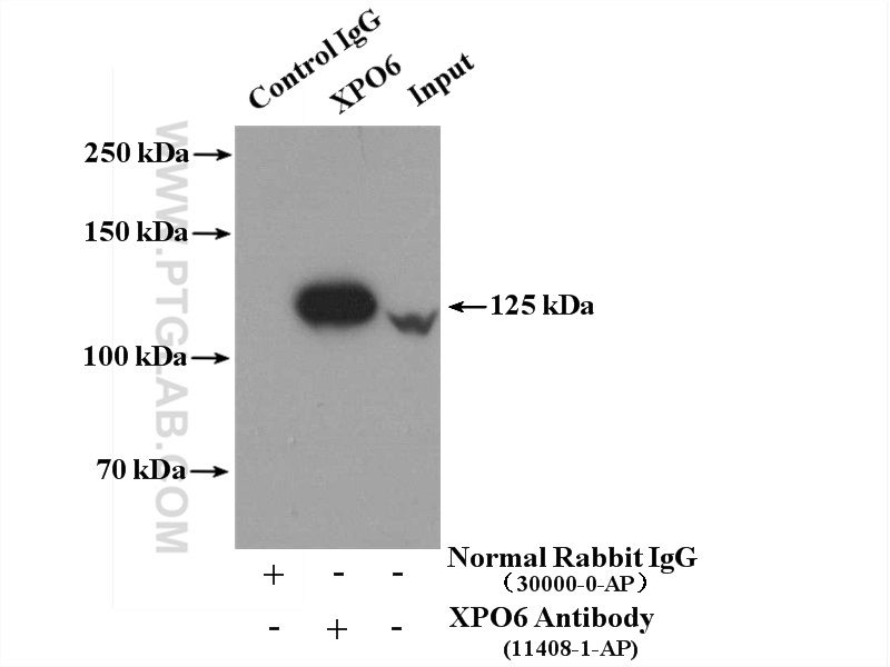 IP experiment of HeLa using 11408-1-AP