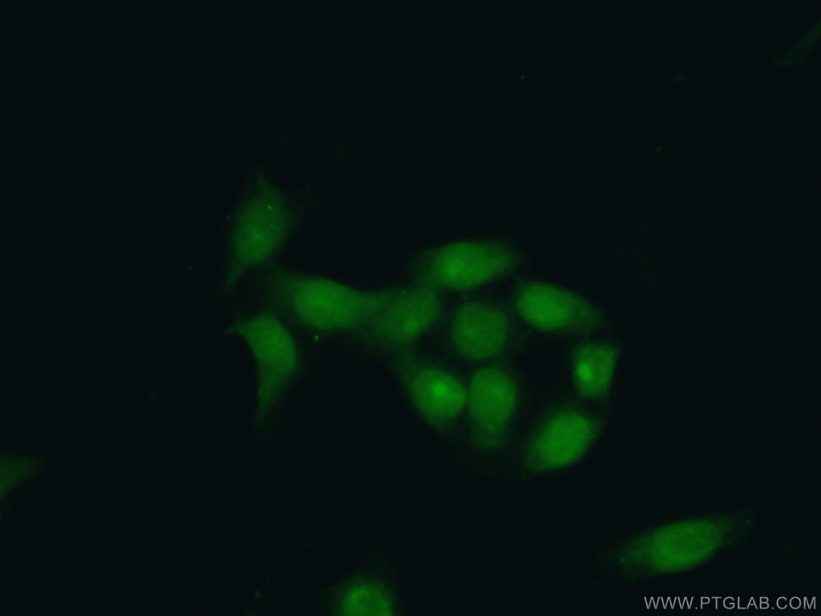IF Staining of HeLa using 21468-1-AP