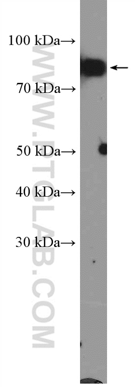 WB analysis of K-562 using 21468-1-AP