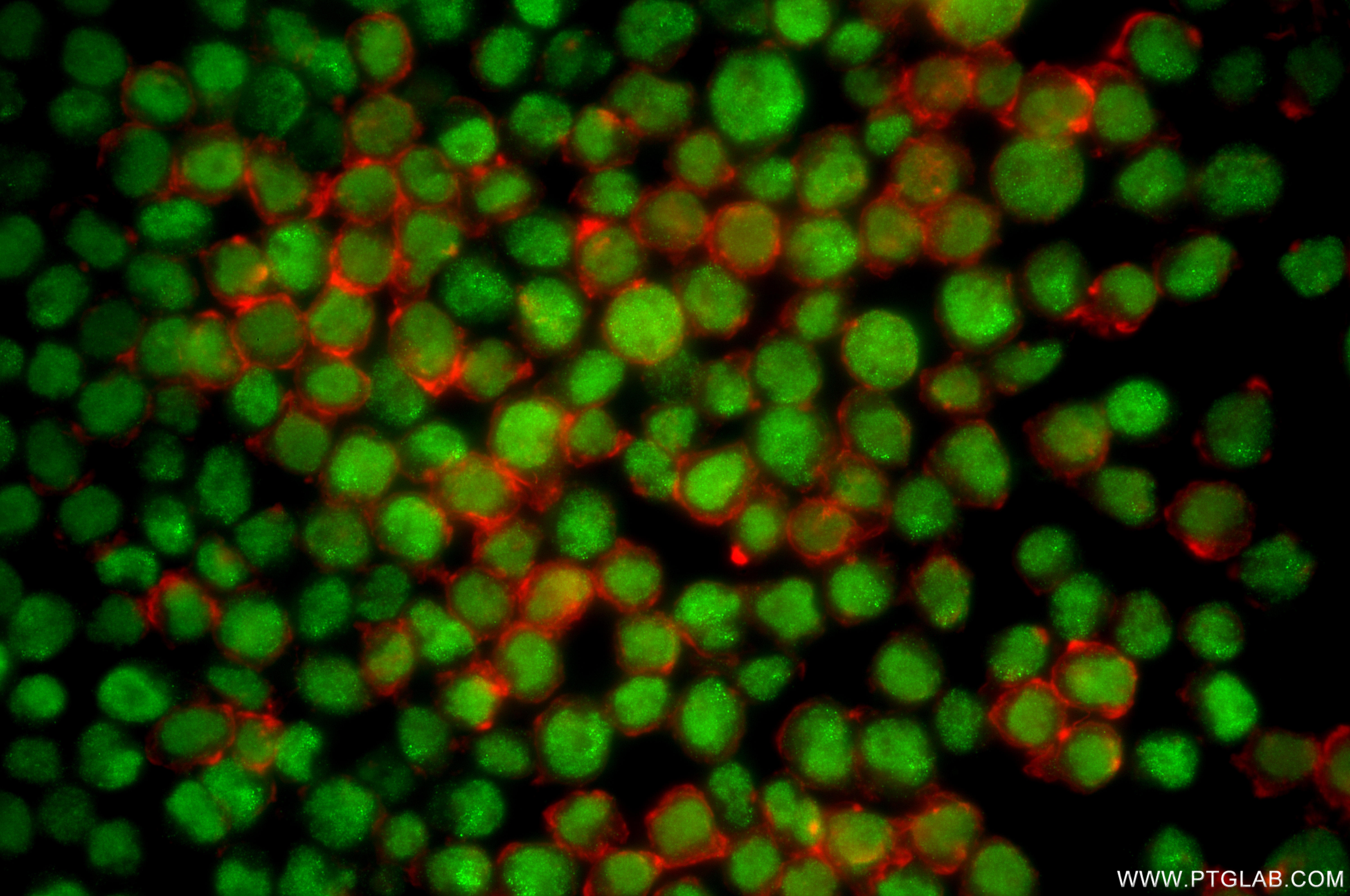 IF Staining of Jurkat using 87251-1-RR IF Staining of Jurkat using 87251-1-RR