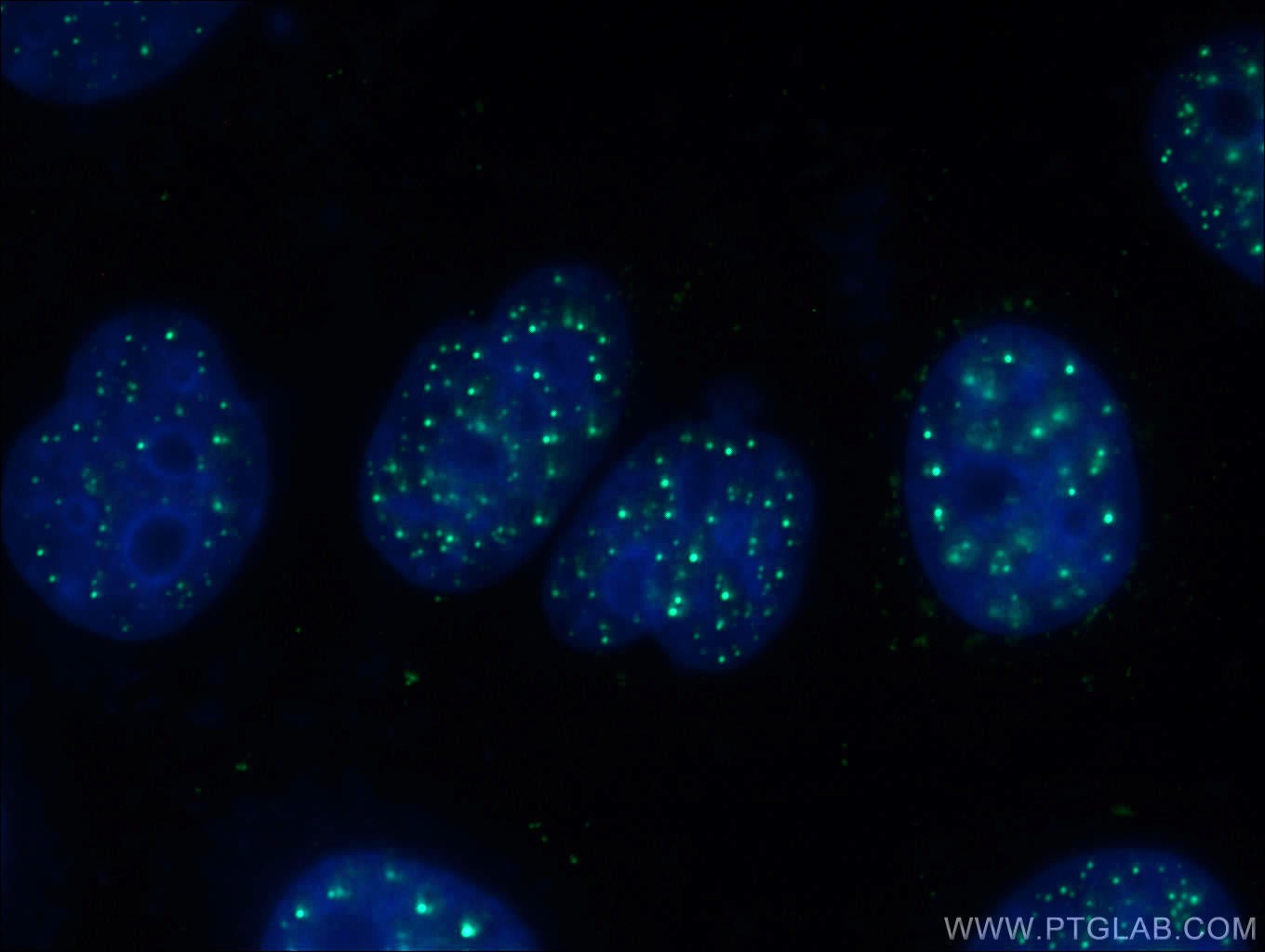 IF Staining of HepG2 using 66652-1-Ig (same clone as 66652-1-PBS)