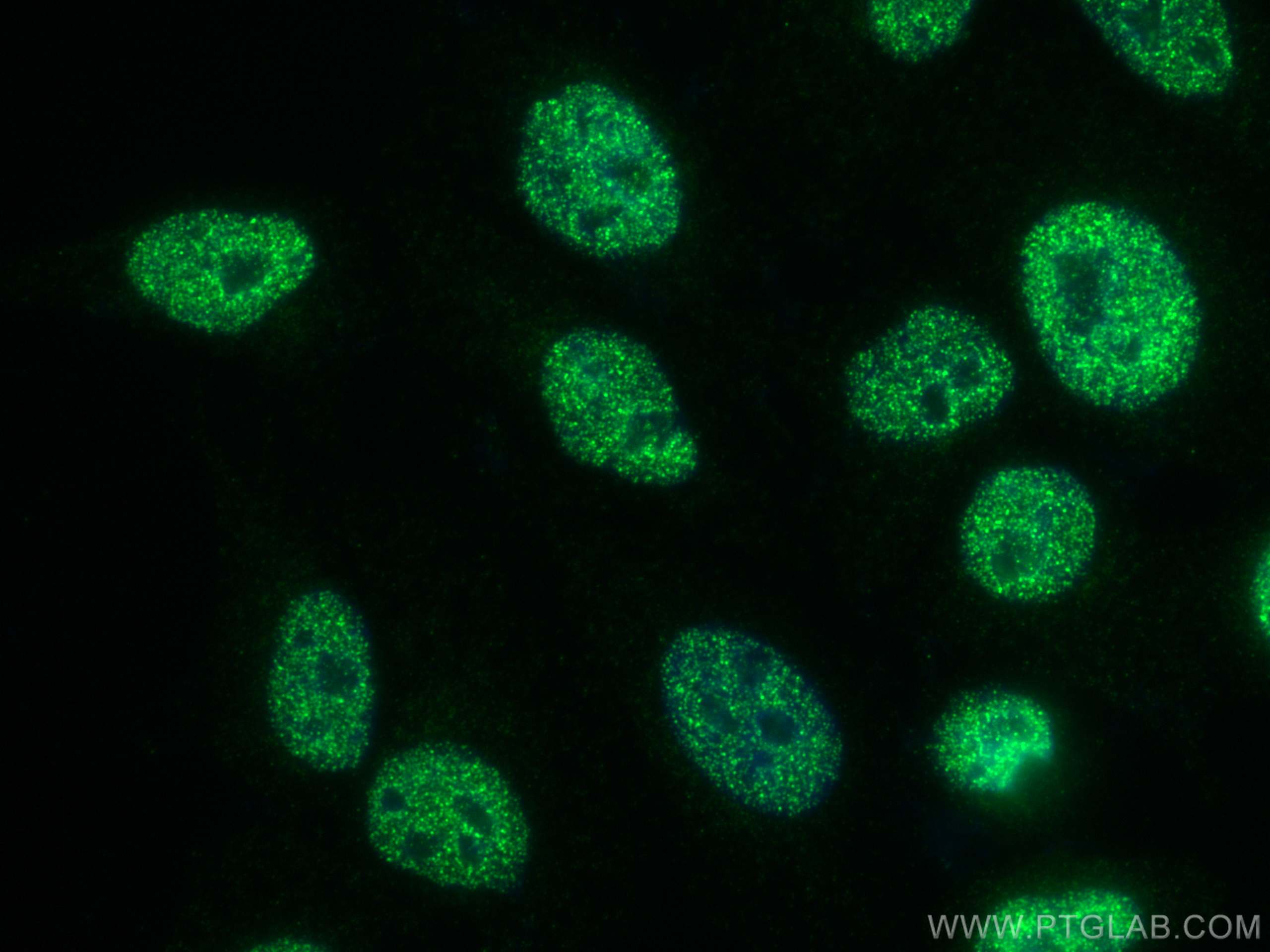 IF Staining of HepG2 using 66652-1-Ig (same clone as 66652-1-PBS)