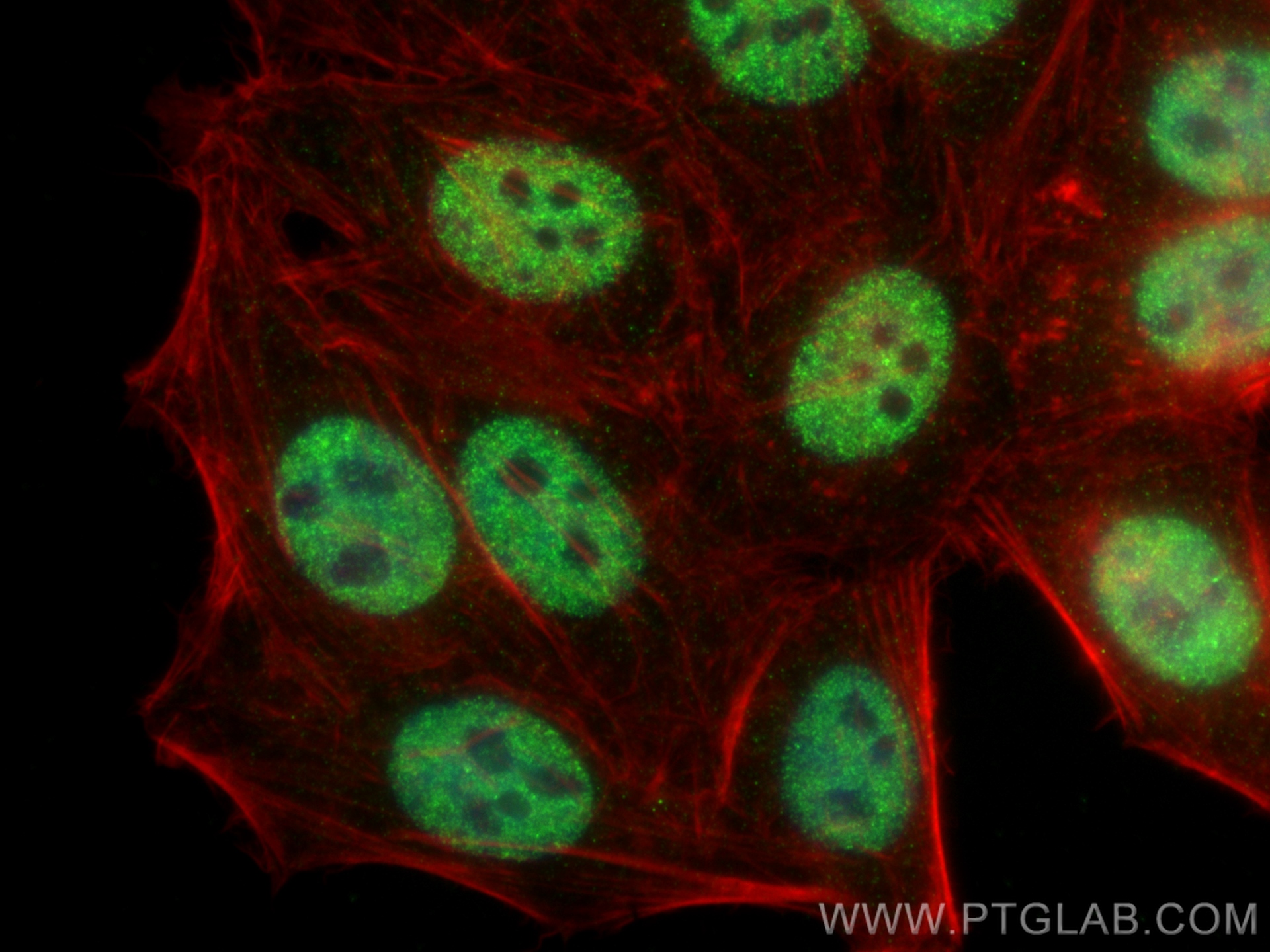 IF Staining of HepG2 using 66652-1-Ig (same clone as 66652-1-PBS)