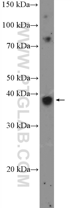 WB analysis of MCF-7 using 18494-1-AP