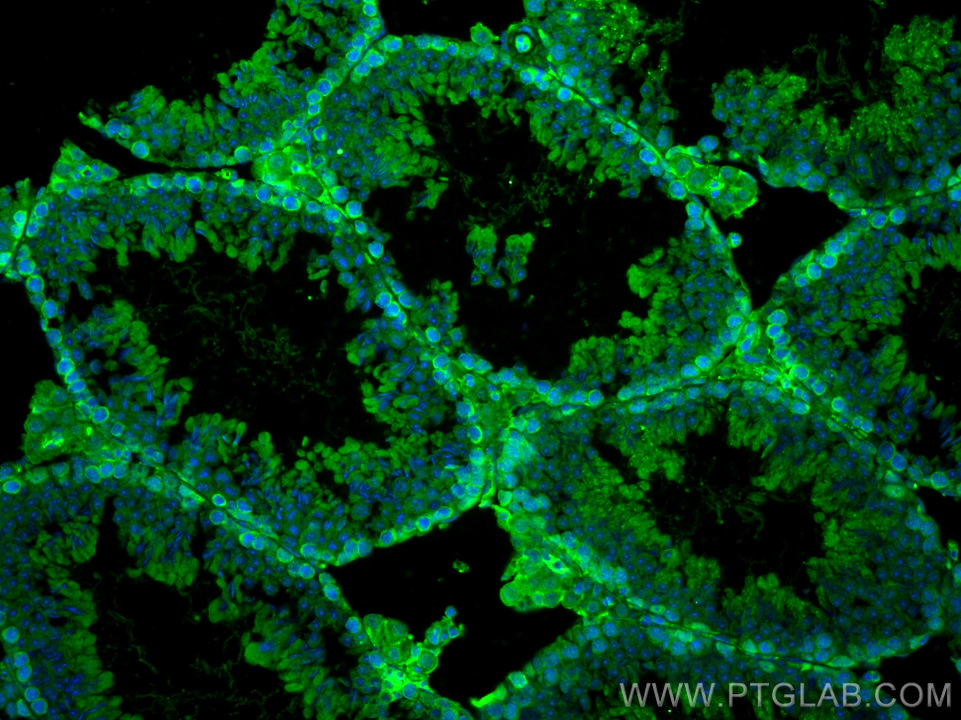 IF Staining of mouse testis using 67222-1-Ig (same clone as 67222-1-PBS)