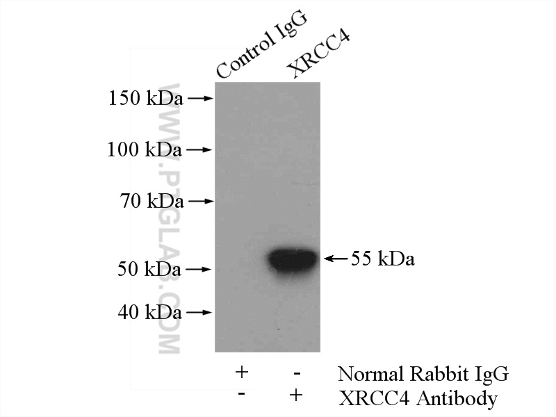 IP experiment of HepG2 using 15817-1-AP