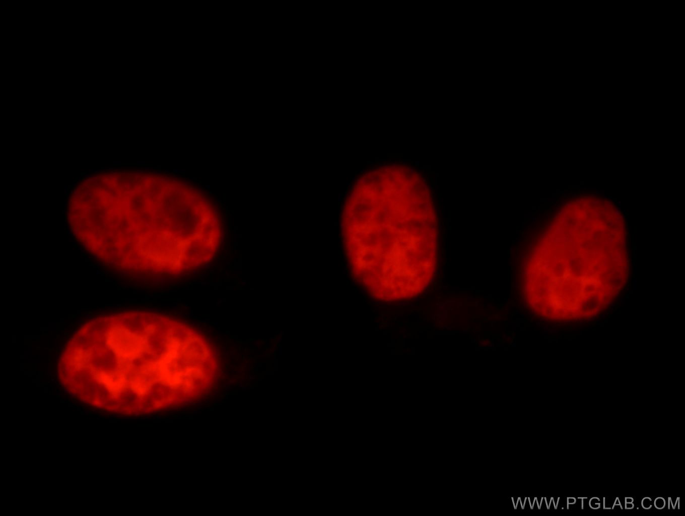 IF Staining of HepG2 using 16389-1-AP