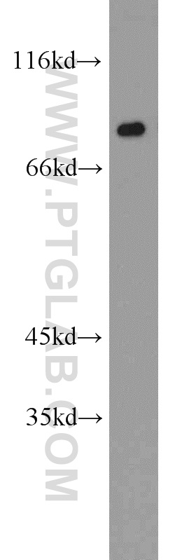 WB analysis of HepG2 using 16389-1-AP