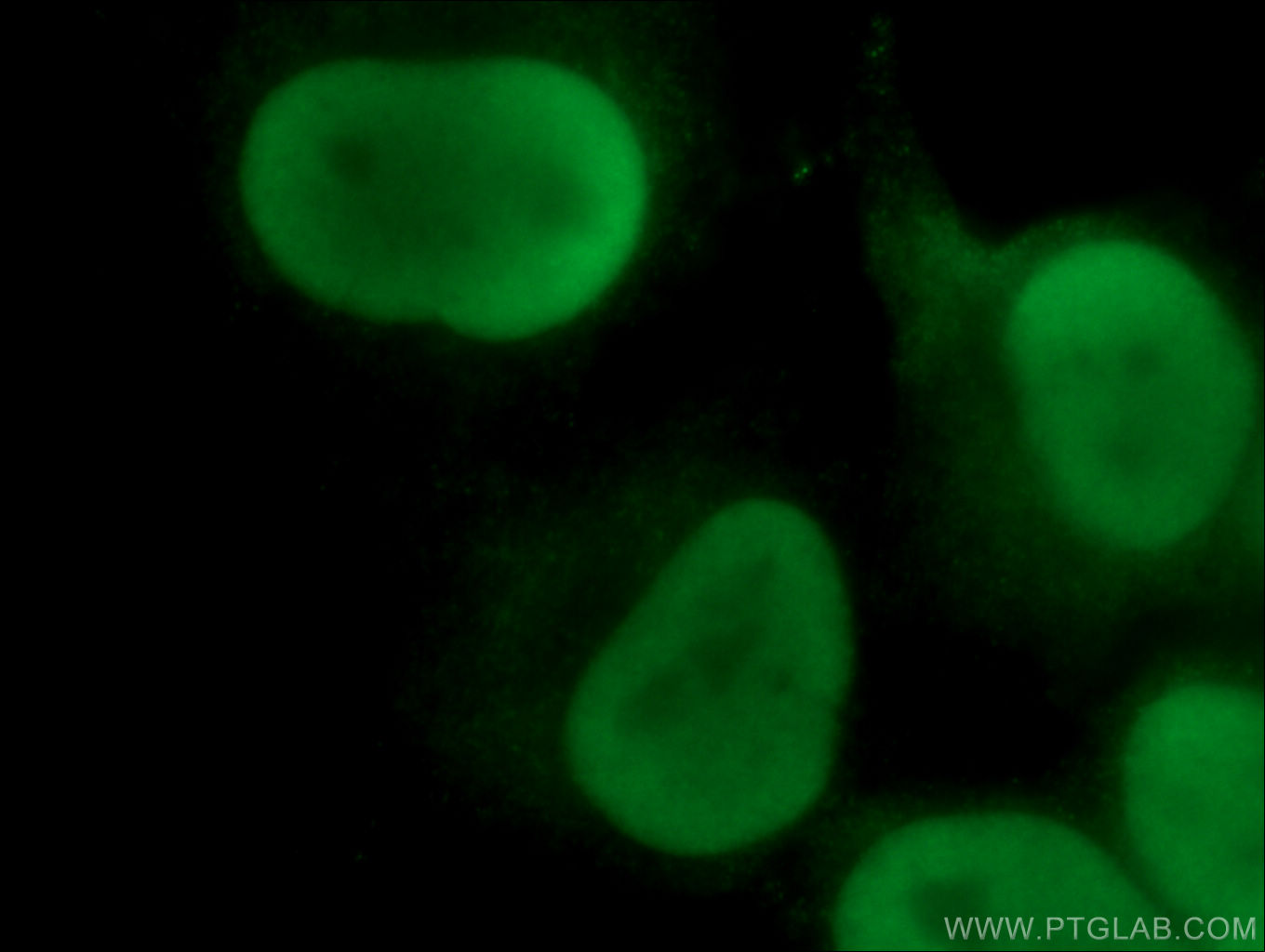 IF Staining of HeLa using 66546-1-Ig (same clone as 66546-1-PBS)