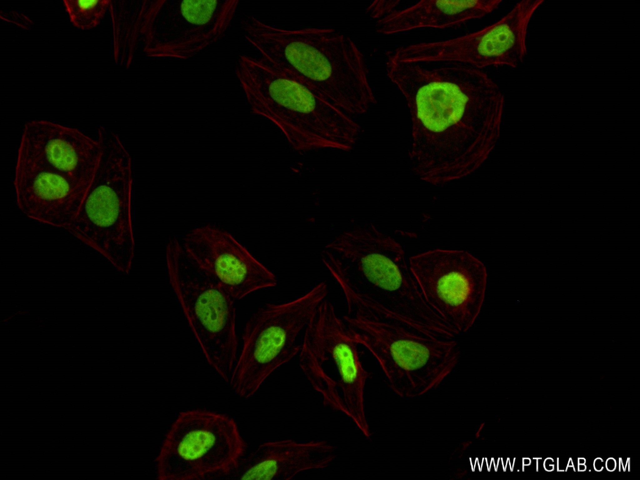 IF Staining of HepG2 using 80325-6-RR