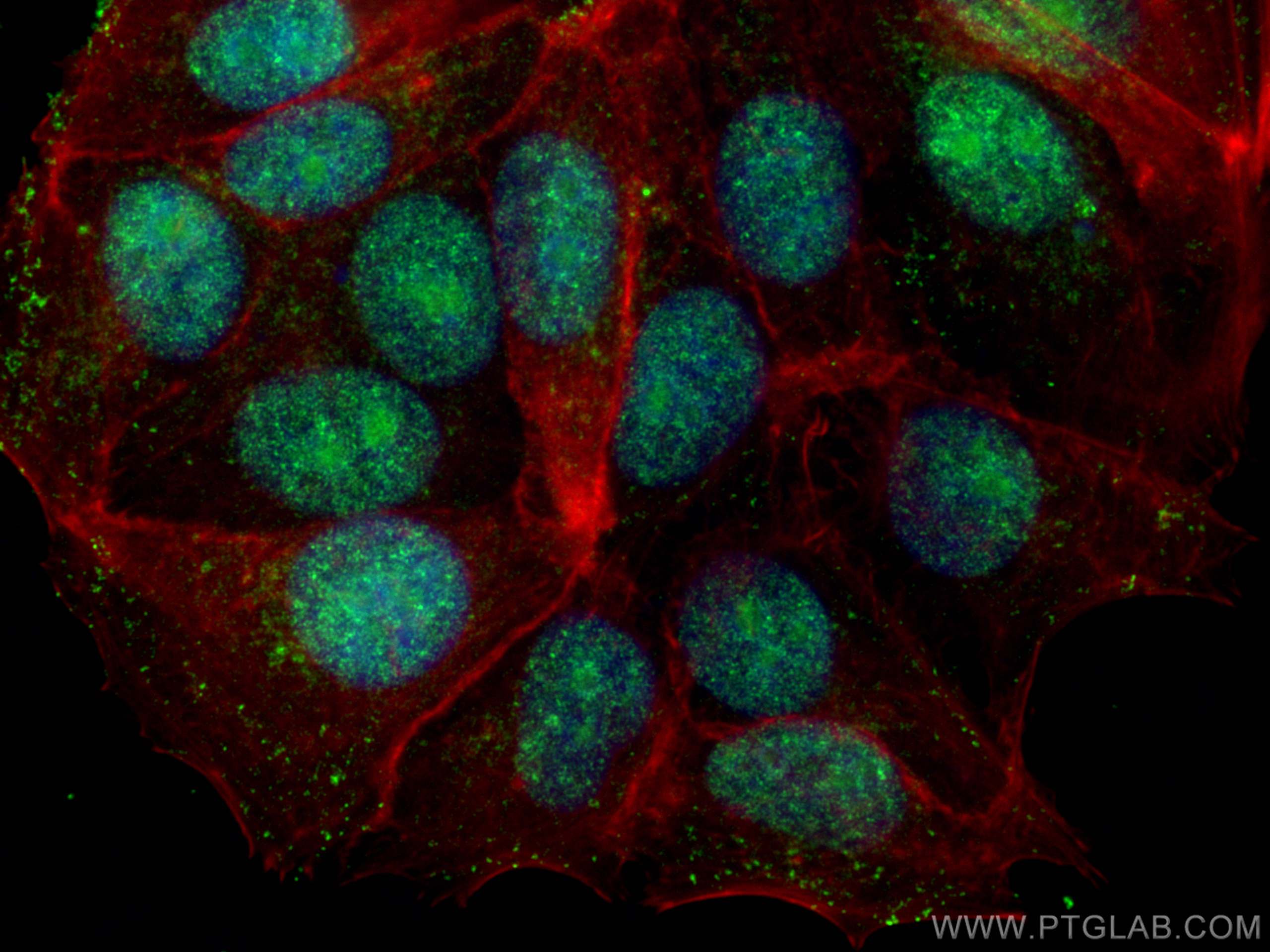 IF Staining of MCF-7 using 66852-1-Ig