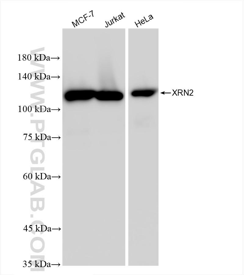 WB analysis using 83378-1-RR