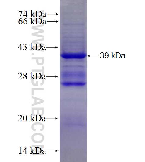 XRN2 fusion protein Ag27927 SDS-PAGE