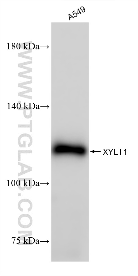 WB analysis using 85008-1-RR