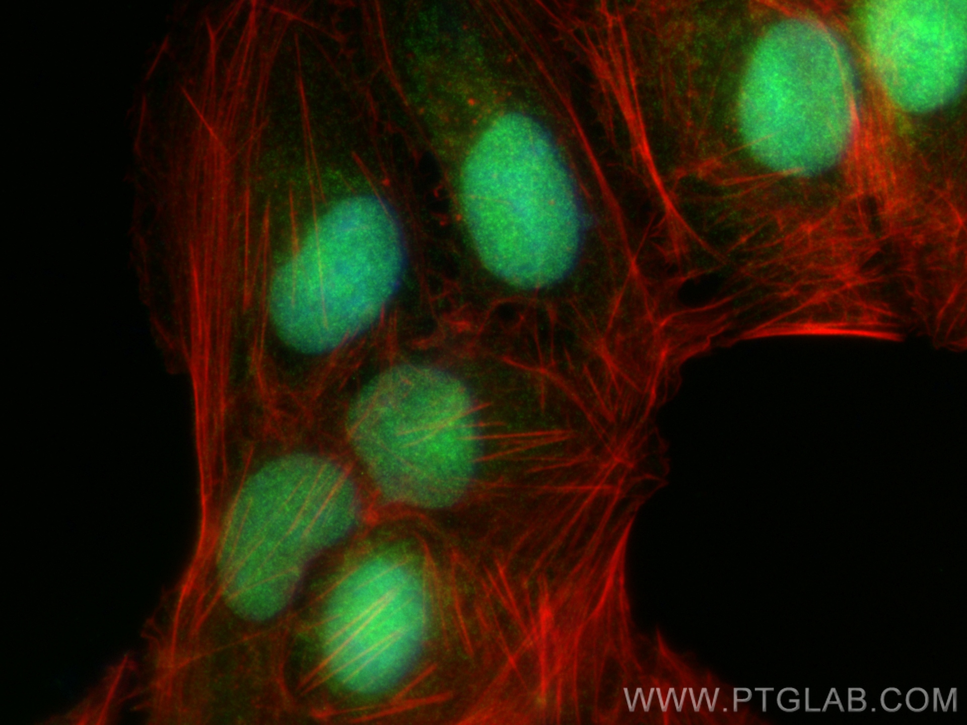 IF Staining of U2OS using 13980-1-AP