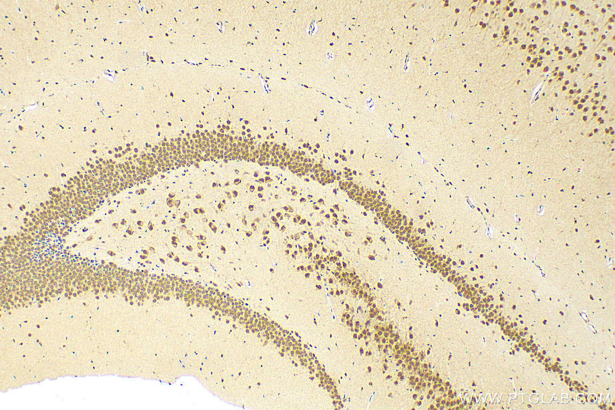 IHC staining of mouse brain using 13980-1-AP