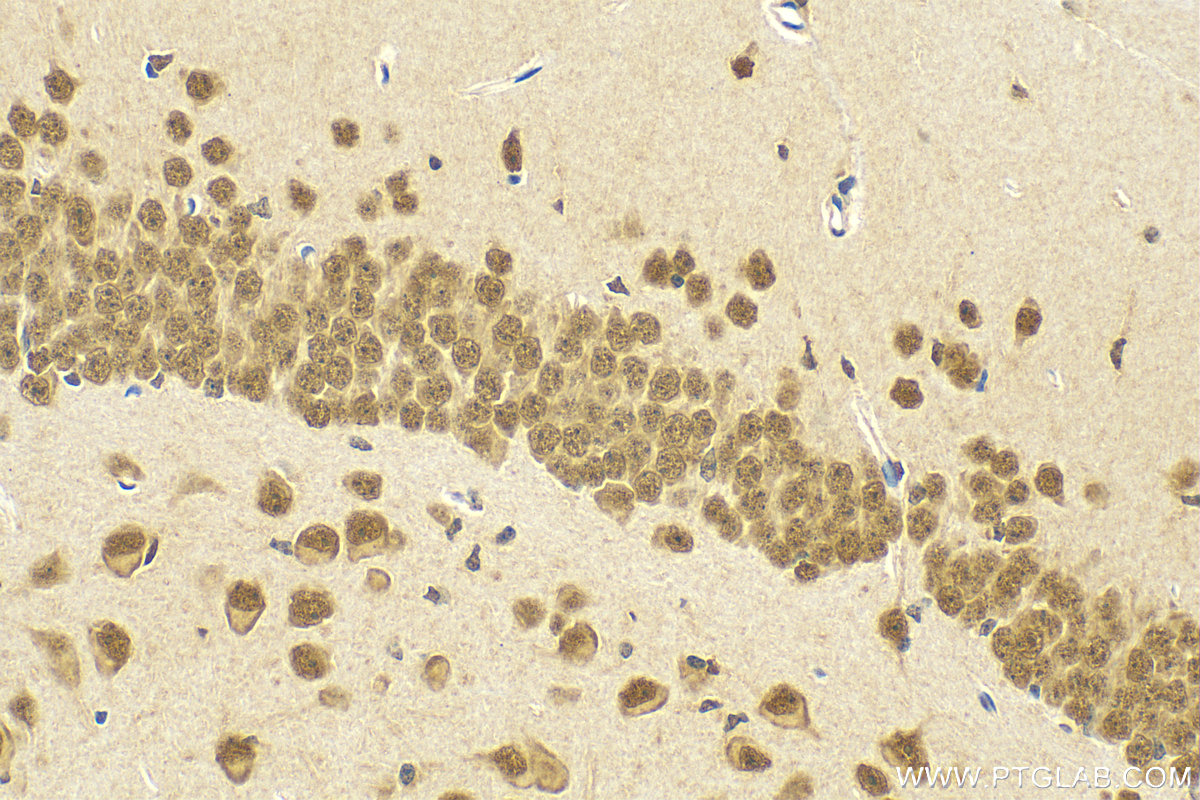 IHC staining of mouse brain using 13980-1-AP