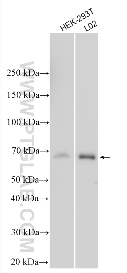 WB analysis using 13584-1-AP