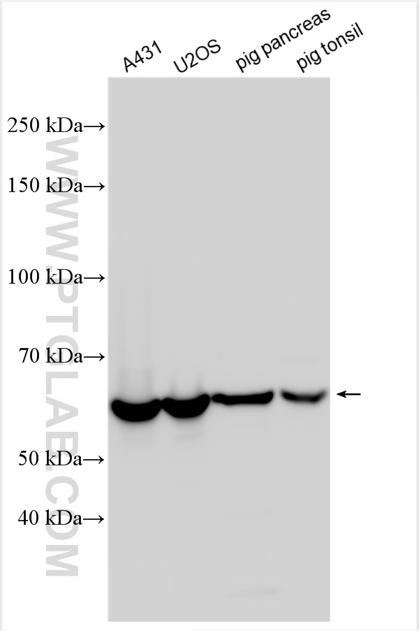 WB analysis using 31228-1-AP