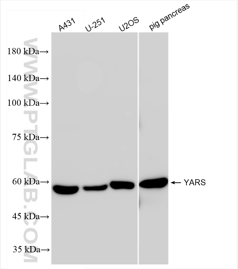 WB analysis using 84859-3-RR
