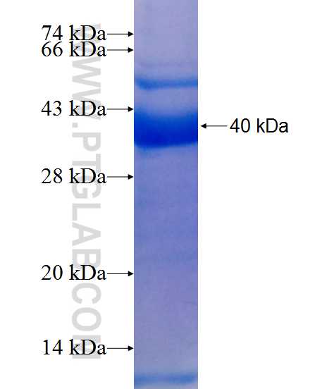 YARS2 fusion protein Ag9506 SDS-PAGE YARS2 fusion protein Ag9506 SDS-PAGE