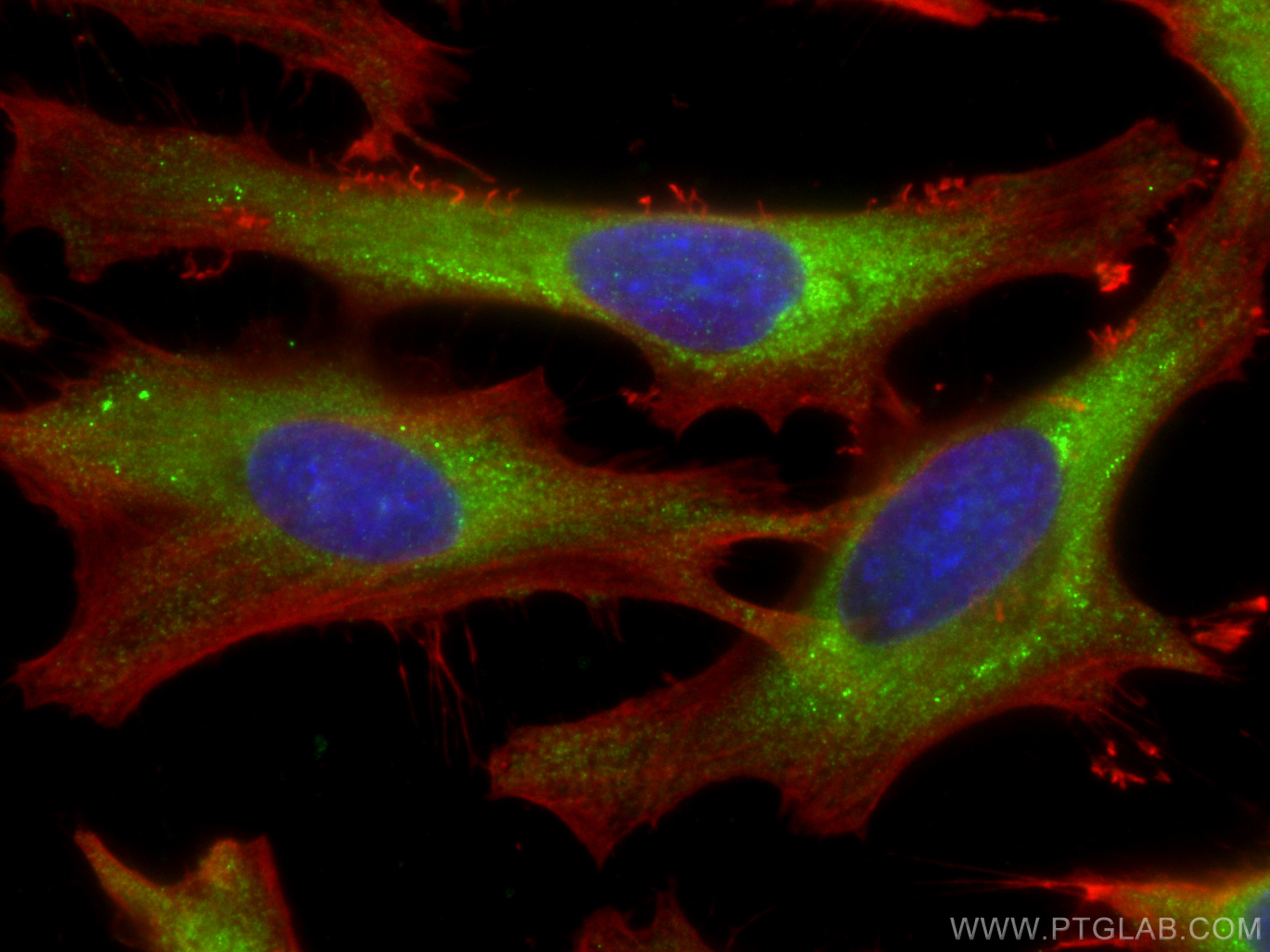 IF Staining of HeLa using 20339-1-AP