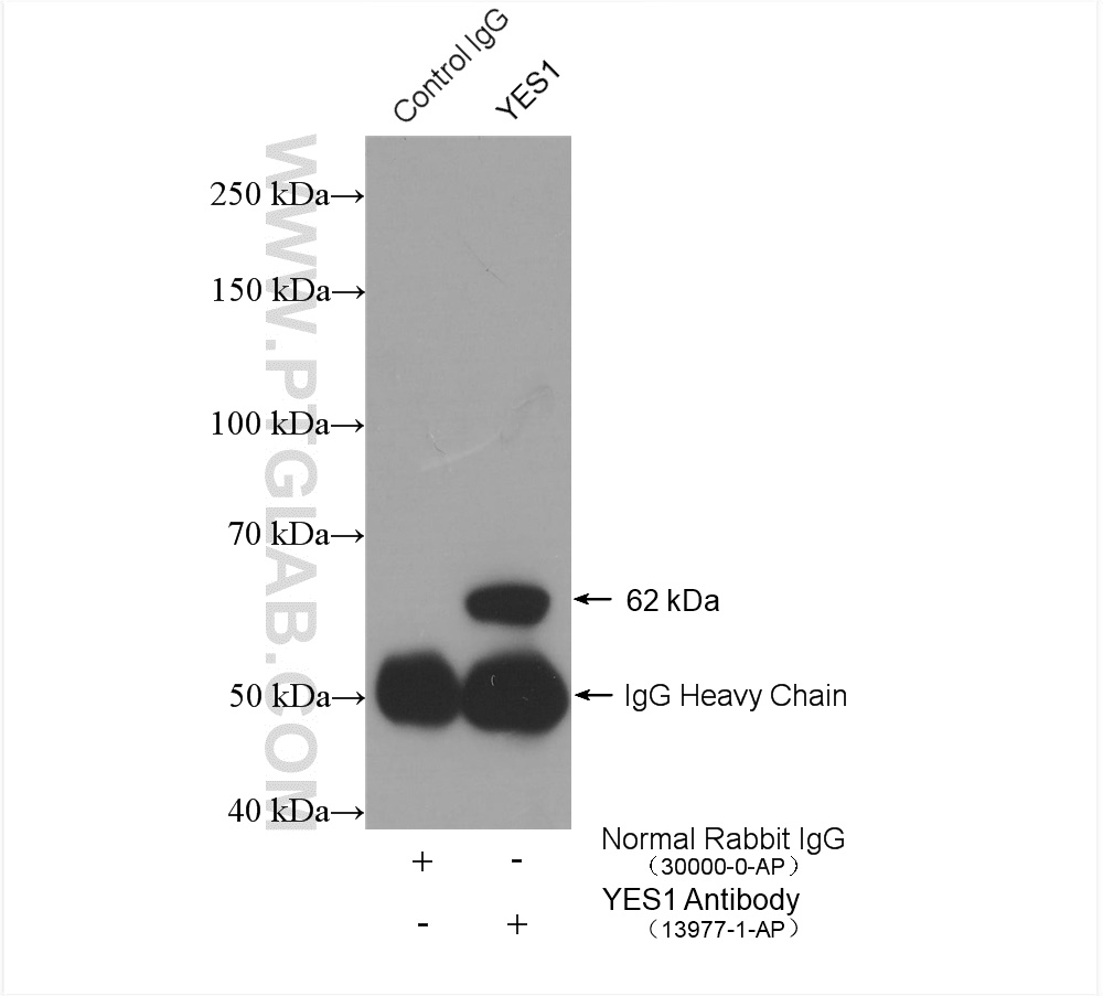 IP experiment of A431 using 13977-1-AP