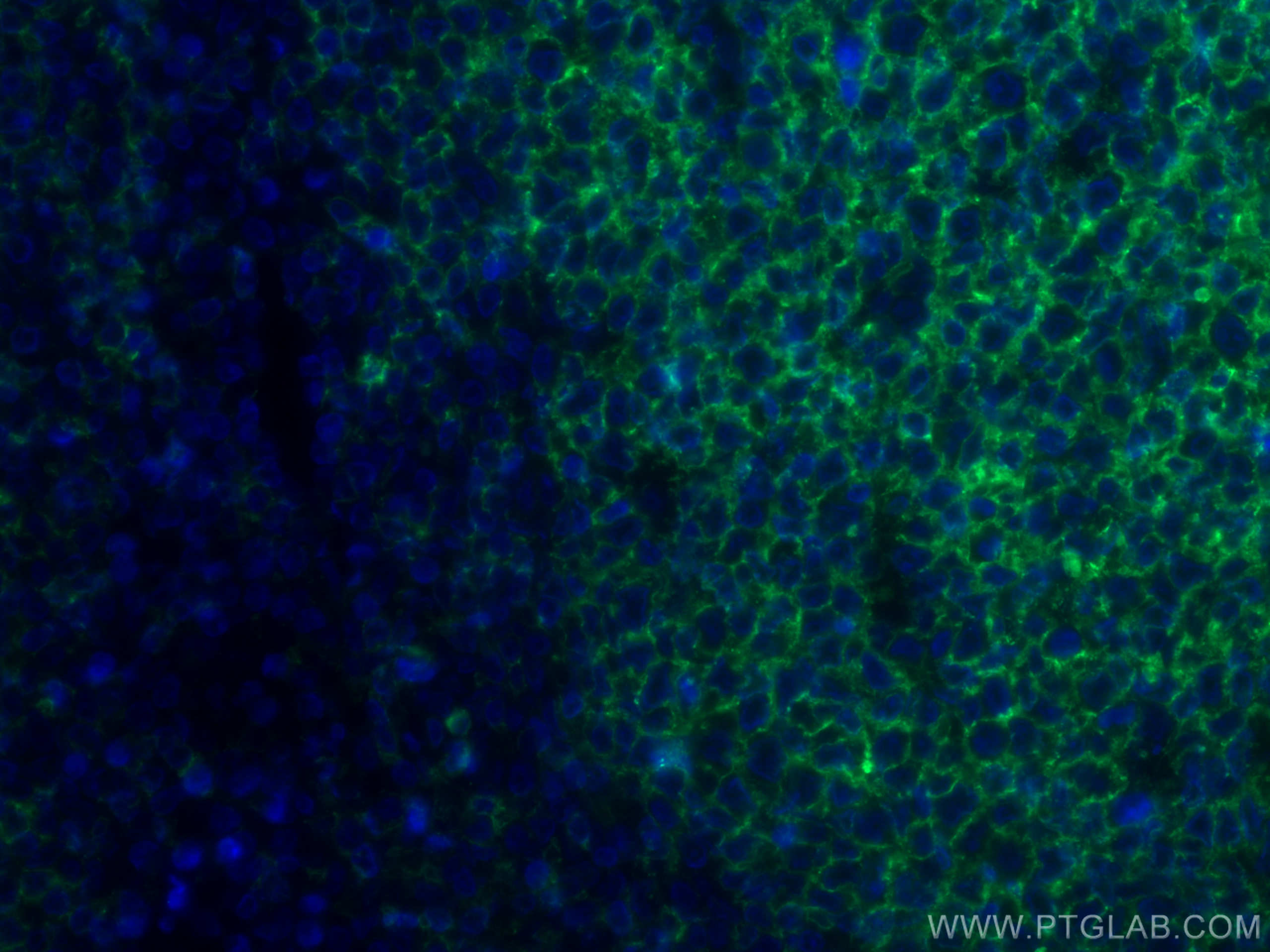 IF Staining of human tonsillitis using CL488-60271