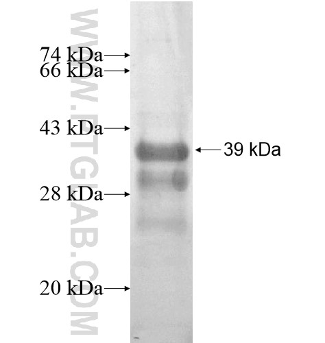 YIPF2 fusion protein Ag14238 SDS-PAGE