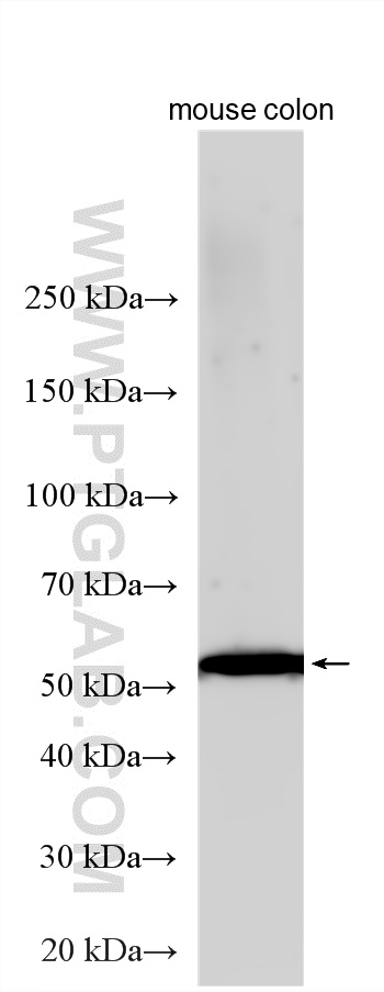 Various lysates were subjected to SDS PAGE followed by western blot with 30243-1-AP (YIPF6 antibody) at dilution of 1:1000 incubated at room temperature for 1.5 hours. WB analysis using 30243-1-AP