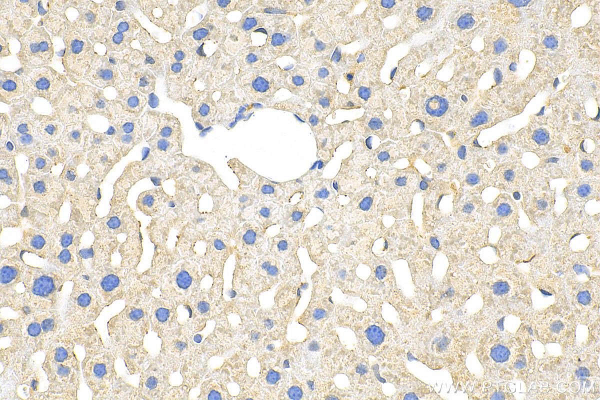 IHC staining of mouse liver using 21347-1-AP