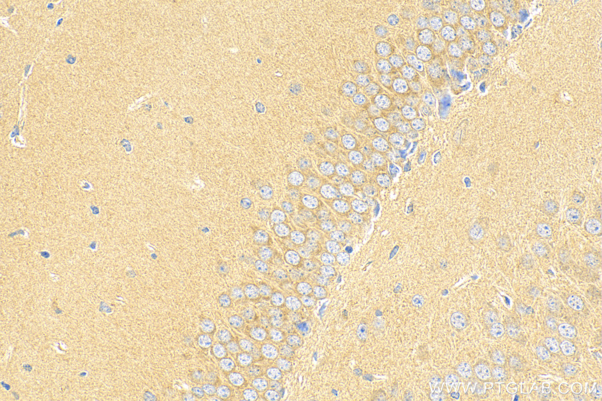 IHC staining of mouse brain using 21347-1-AP