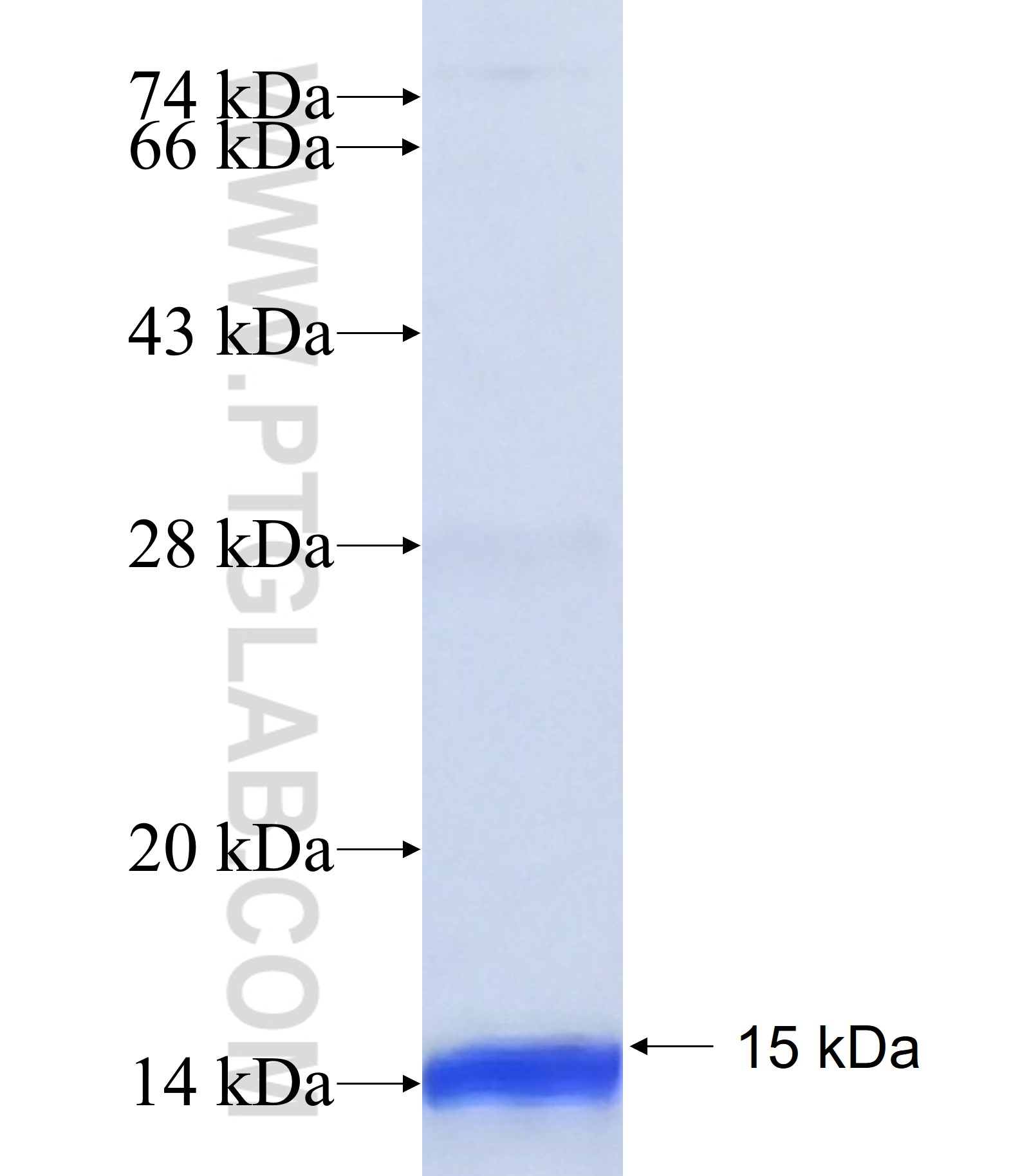 YKT6 fusion protein Ag38880 SDS-PAGE YKT6 fusion protein Ag38880 SDS-PAGE