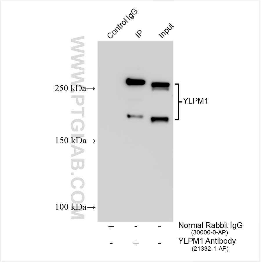 IP experiment of Neuro-2a using 21332-1-AP