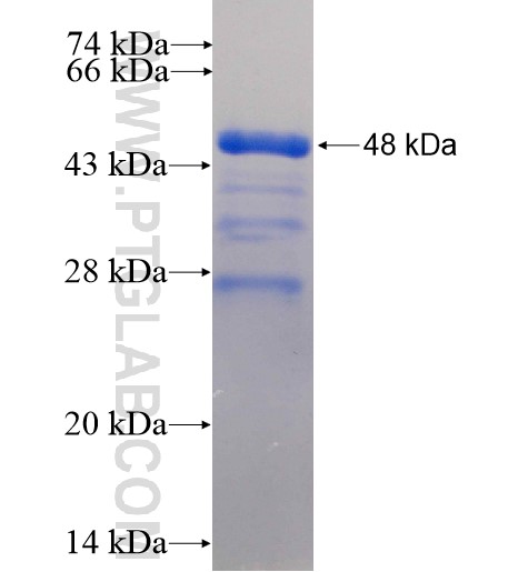 YLPM1 fusion protein Ag15270 SDS-PAGE YLPM1 fusion protein Ag15270 SDS-PAGE