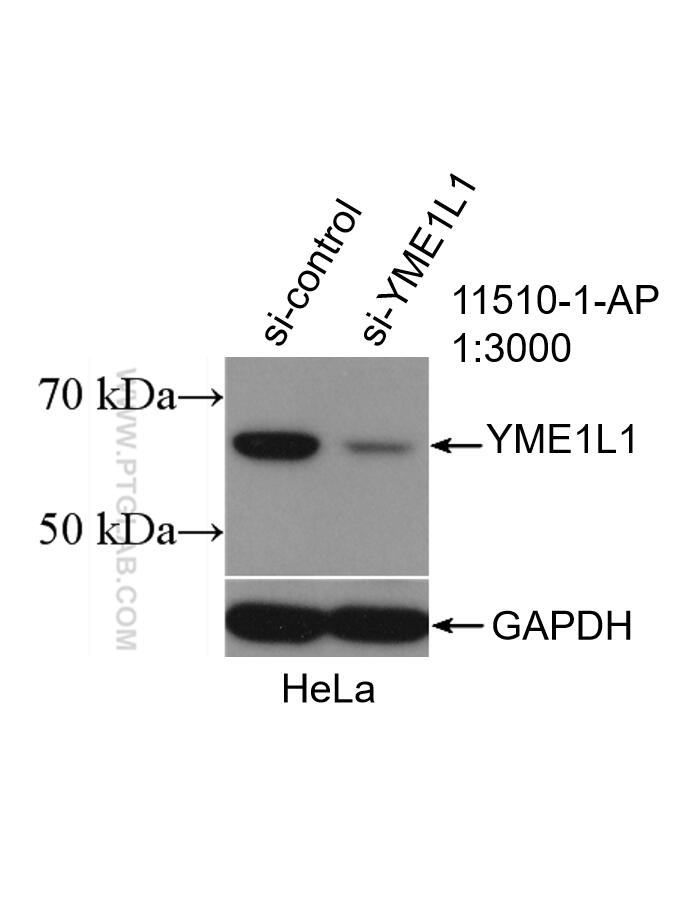 WB analysis of HeLa using 11510-1-AP