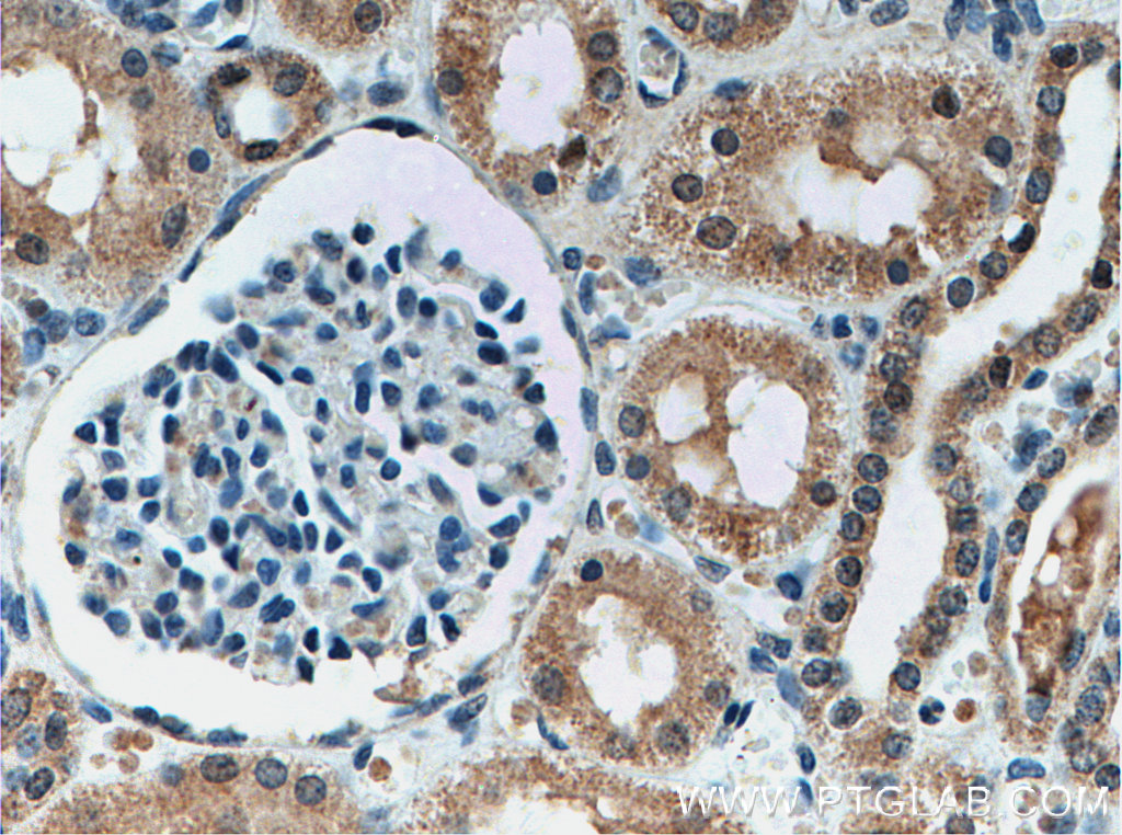 IHC staining of human kidney using 66551-1-Ig