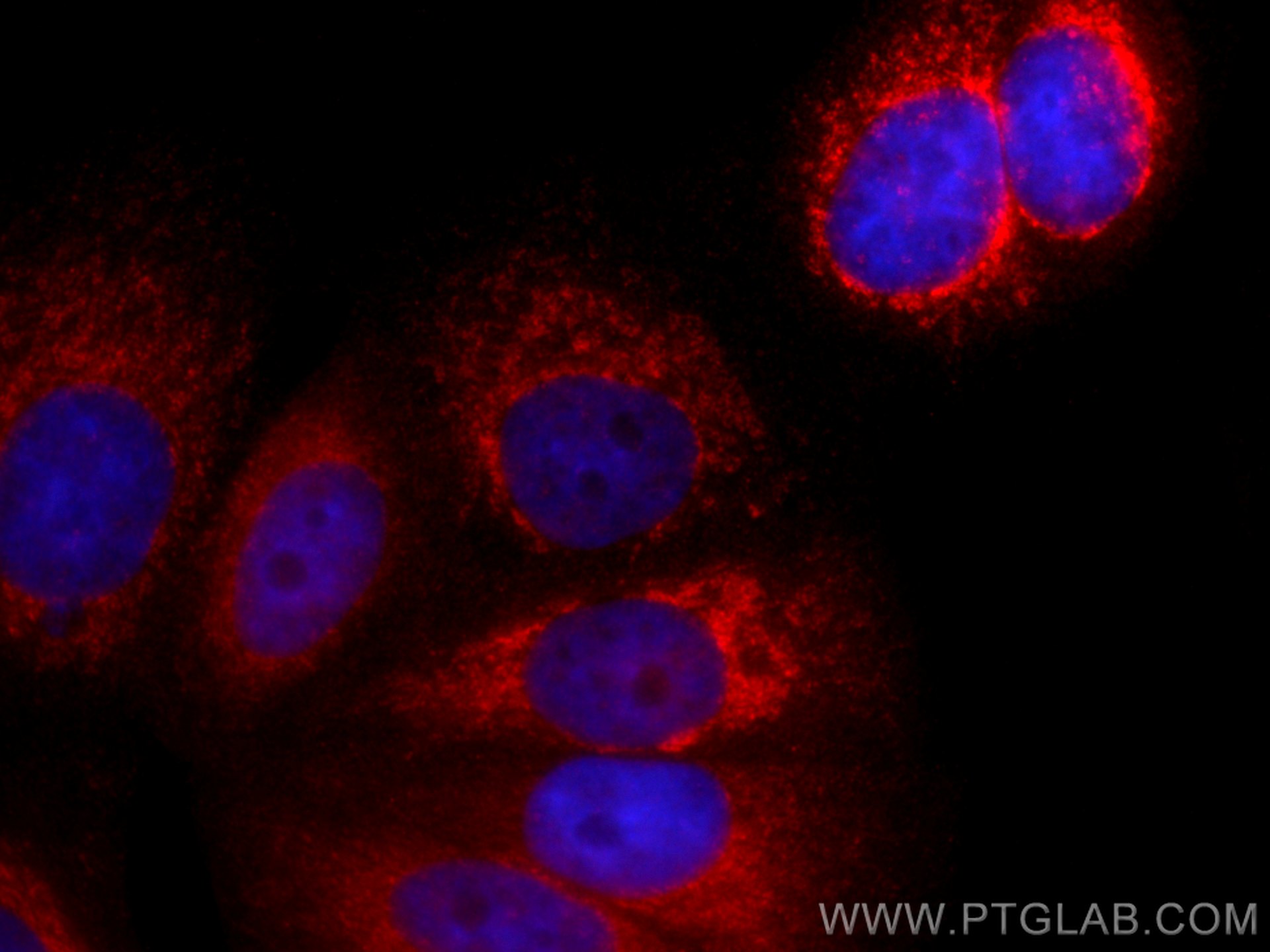 IF Staining of MCF-7 using CL594-11510