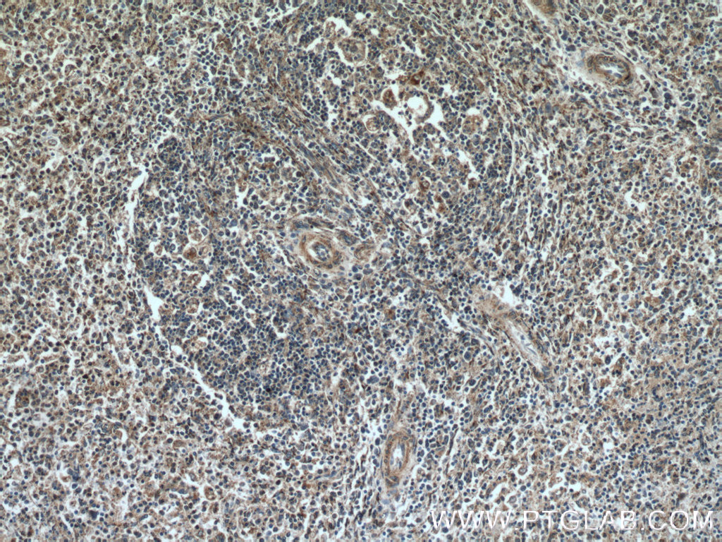 IHC staining of human spleen using 25370-1-AP