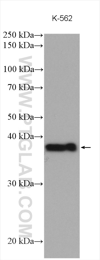 WB analysis using 25370-1-AP